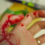 World haemophilia day. Bleeding men and women.